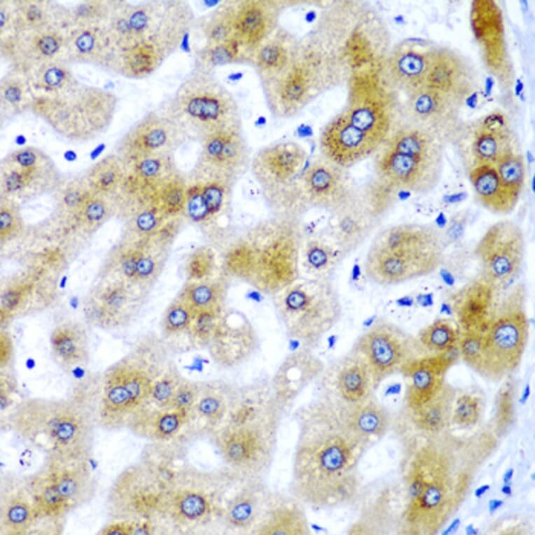 Immunohistochemistry - Anti-SECISBP2 Antibody (A9982) - Antibodies.com