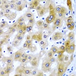 Immunohistochemistry - Anti-SECISBP2 Antibody (A9982) - Antibodies.com