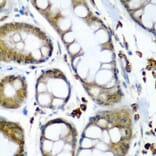 Immunohistochemistry - Anti-SECISBP2 Antibody (A9982) - Antibodies.com