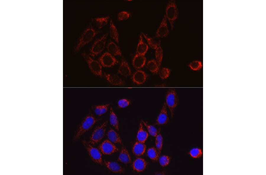 Immunofluorescence - Anti-SECISBP2 Antibody (A9982) - Antibodies.com