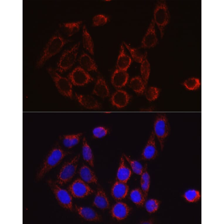 Immunofluorescence - Anti-SECISBP2 Antibody (A9982) - Antibodies.com