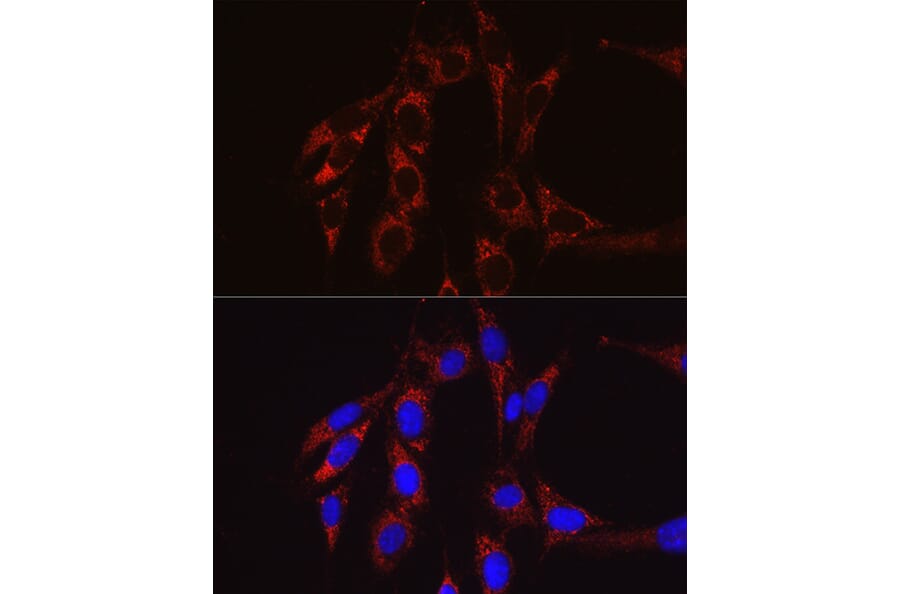 Immunofluorescence - Anti-SECISBP2 Antibody (A9982) - Antibodies.com