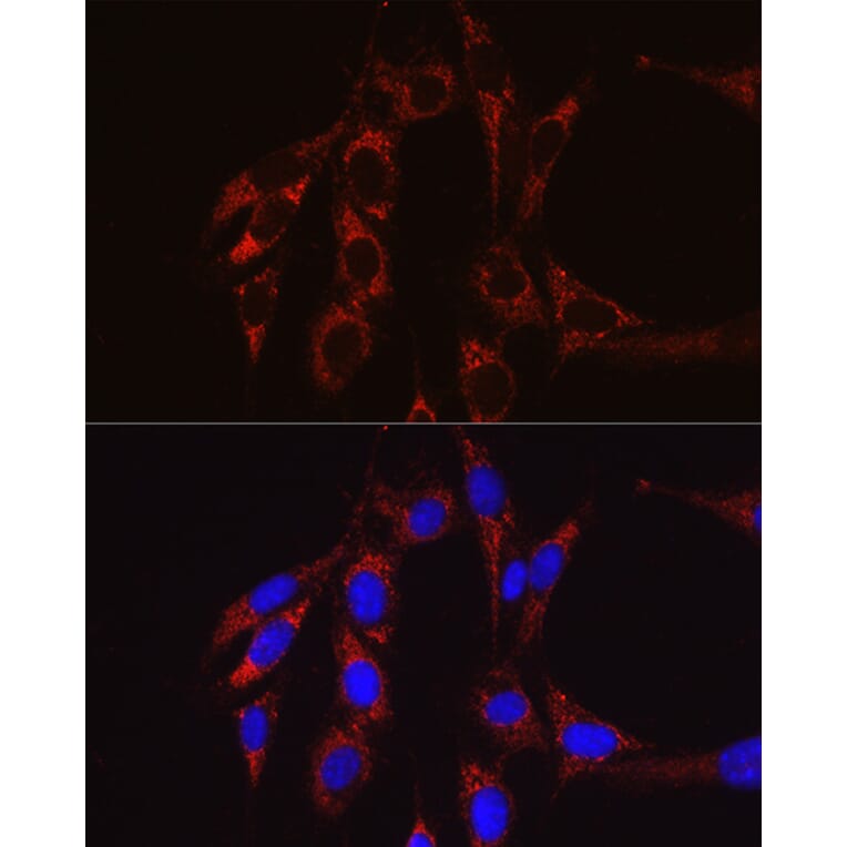 Immunofluorescence - Anti-SECISBP2 Antibody (A9982) - Antibodies.com