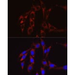 Immunofluorescence - Anti-SECISBP2 Antibody (A9982) - Antibodies.com