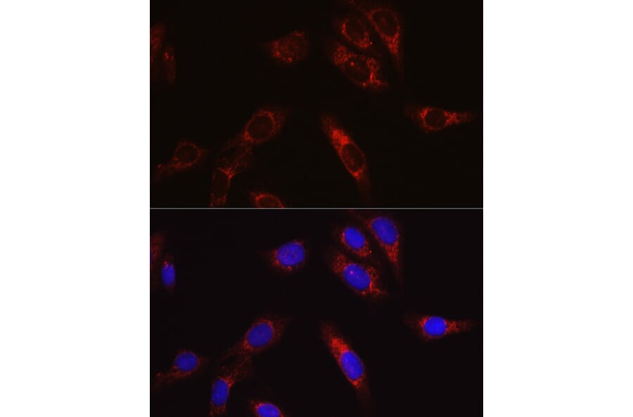 Immunofluorescence - Anti-SECISBP2 Antibody (A9982) - Antibodies.com