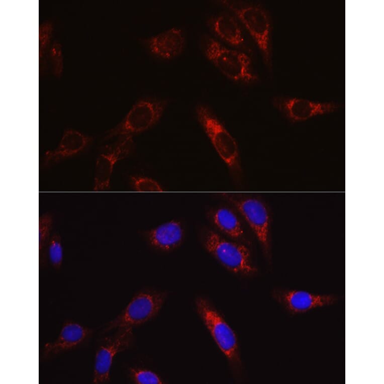 Immunofluorescence - Anti-SECISBP2 Antibody (A9982) - Antibodies.com