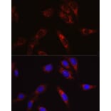 Immunofluorescence - Anti-SECISBP2 Antibody (A9982) - Antibodies.com