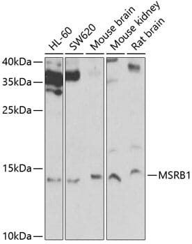 Western blot analysis of extracts of various cell lines, using Anti-MSRB1 Antibody (A6737) at 1:1,000 dilution.
Secondary antibody: Goat Anti-Rabbit IgG (H+L) (HRP) (AS014) at 1:10,000 dilution.
Lysates / proteins: 25µg per lane.
Blocking buffer: 3% non-fat dry milk in TBST.
Detection: ECL Basic Kit (RM00020).
Exposure time: 30s.