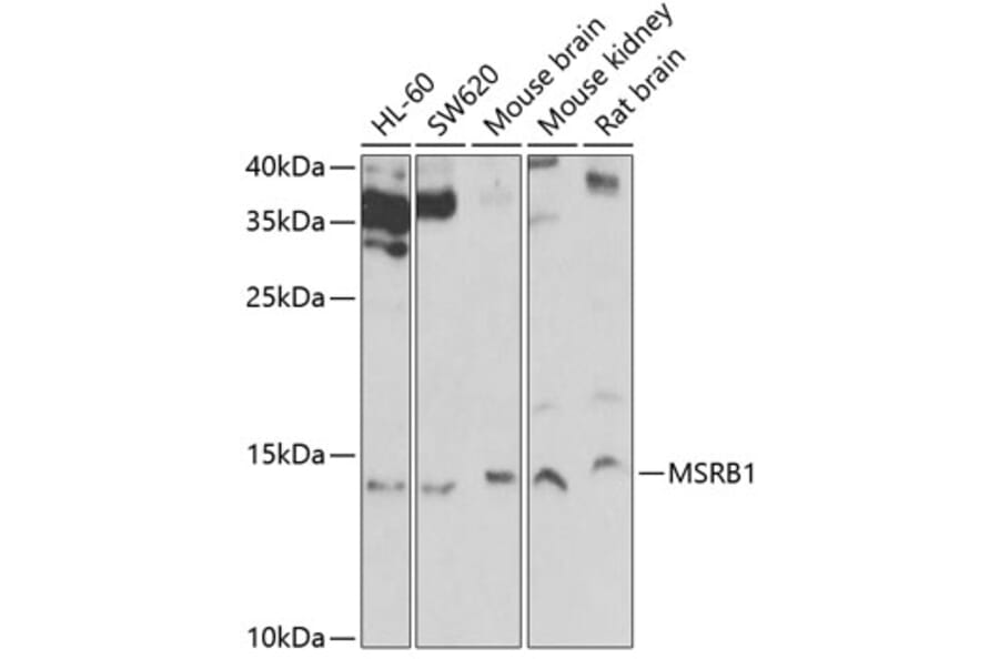 Western Blot - Anti-Methionine Sulfoxid eReductase B Antibody (A9983) - Antibodies.com