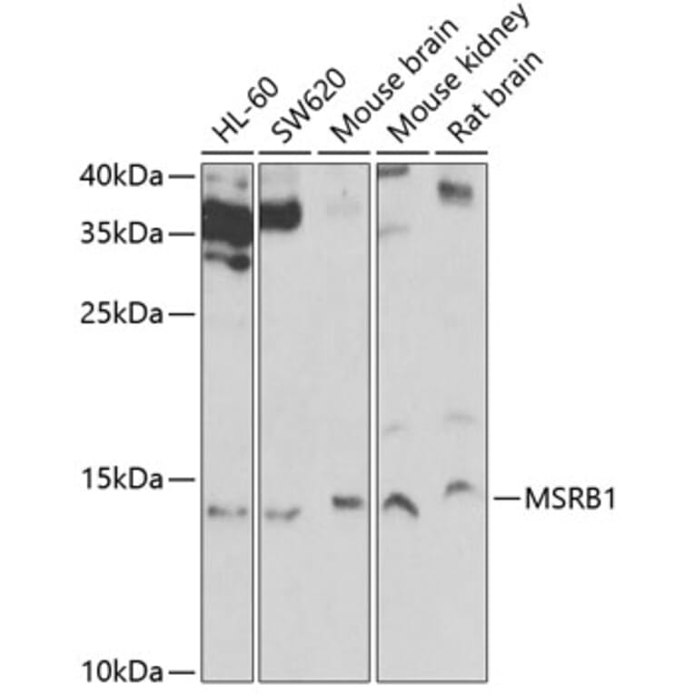 Western Blot - Anti-Methionine Sulfoxid eReductase B Antibody (A9983) - Antibodies.com