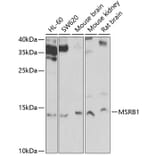 Western Blot - Anti-Methionine Sulfoxid eReductase B Antibody (A9983) - Antibodies.com