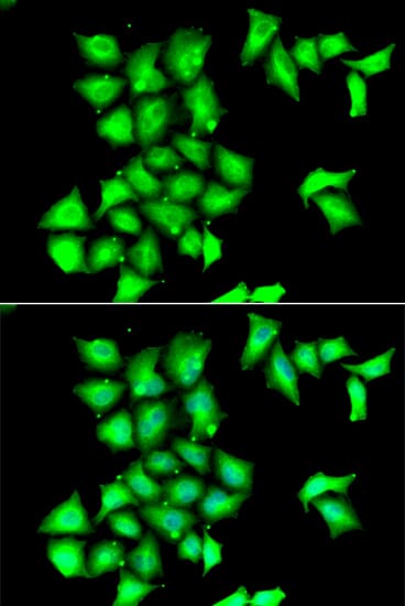 Immunofluorescence analysis of HeLa cells using Anti-MSRB1 Antibody (A6737). Blue: DAPI for nuclear staining.