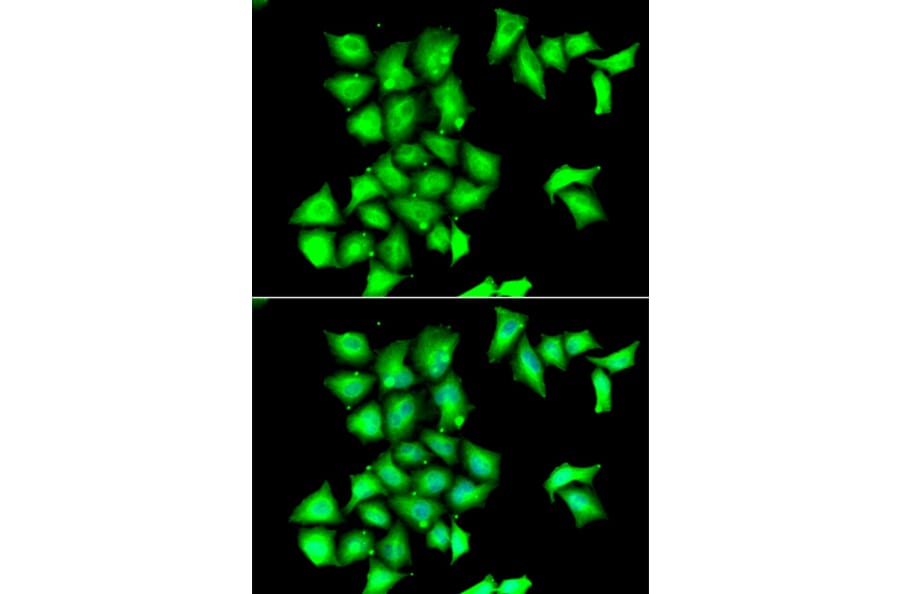 Immunofluorescence - Anti-Methionine Sulfoxid eReductase B Antibody (A9983) - Antibodies.com