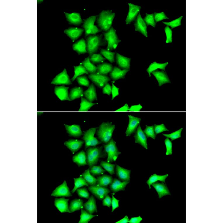 Immunofluorescence - Anti-Methionine Sulfoxid eReductase B Antibody (A9983) - Antibodies.com