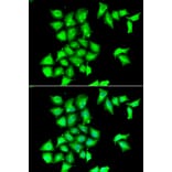 Immunofluorescence - Anti-Methionine Sulfoxid eReductase B Antibody (A9983) - Antibodies.com