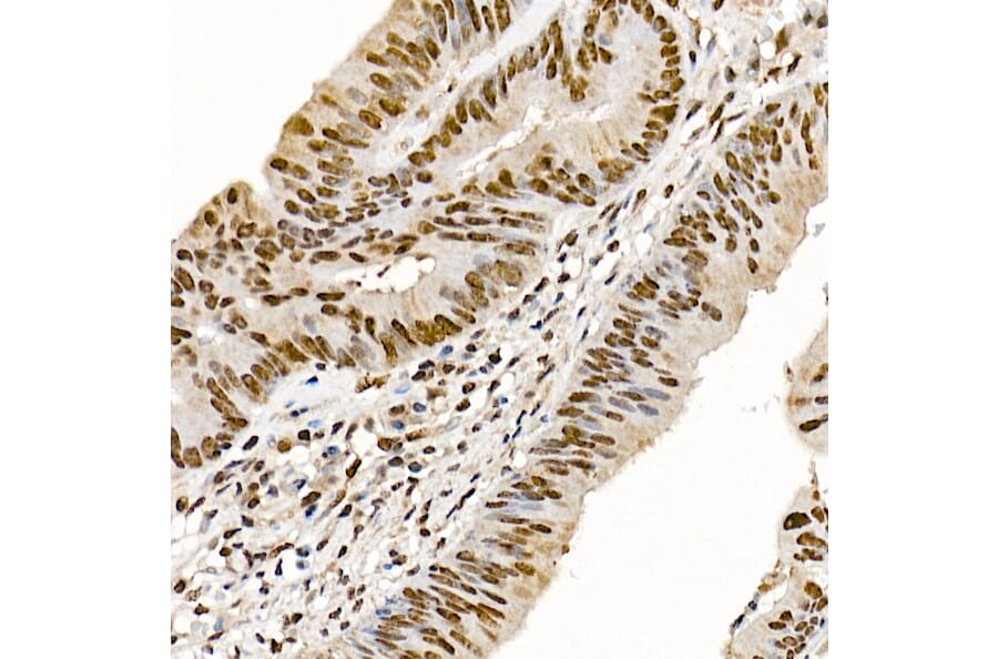 Immunohistochemistry - Anti-Metnase Antibody (A9984) - Antibodies.com