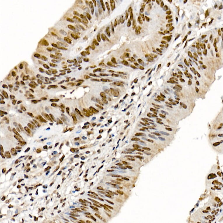 Immunohistochemistry - Anti-Metnase Antibody (A9984) - Antibodies.com
