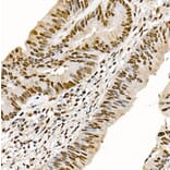Immunohistochemistry - Anti-Metnase Antibody (A9984) - Antibodies.com