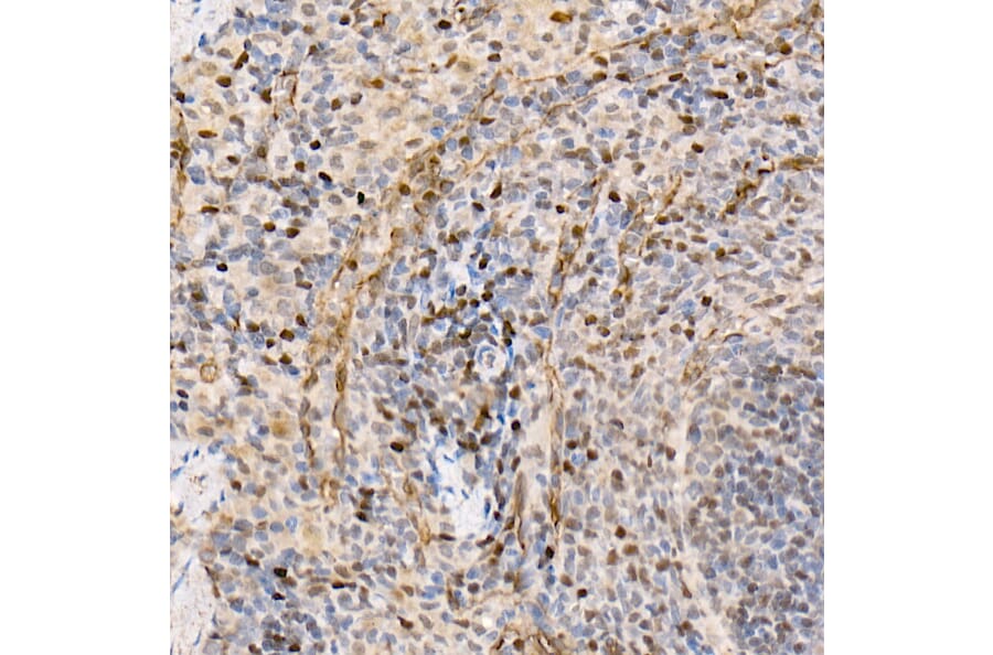 Immunohistochemistry - Anti-Metnase Antibody (A9984) - Antibodies.com