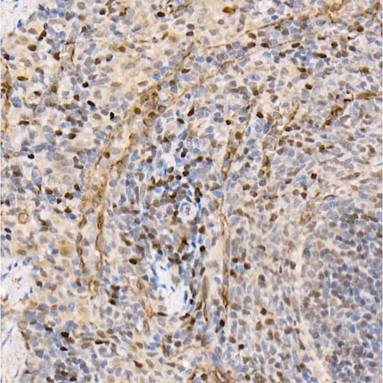 Immunohistochemistry - Anti-Metnase Antibody (A9984) - Antibodies.com