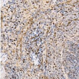 Immunohistochemistry - Anti-Metnase Antibody (A9984) - Antibodies.com