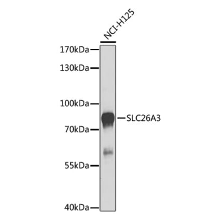 Western Blot - Anti-SLC26A3 Antibody (A9985) - Antibodies.com