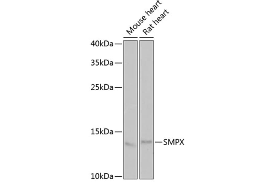 Western Blot - Anti-SMPX Antibody (A6744) - Antibodies.com