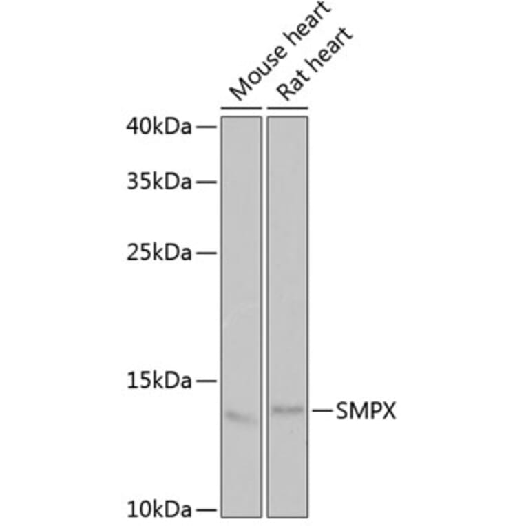 Western Blot - Anti-SMPX Antibody (A6744) - Antibodies.com