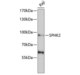 Western Blot - Anti-SPHK2 Antibody (A9987) - Antibodies.com