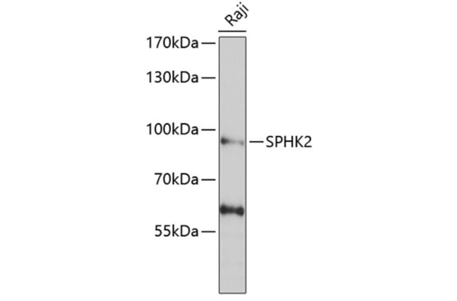 Western Blot - Anti-SPHK2 Antibody (A9987) - Antibodies.com