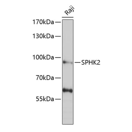 Western Blot - Anti-SPHK2 Antibody (A9987) - Antibodies.com