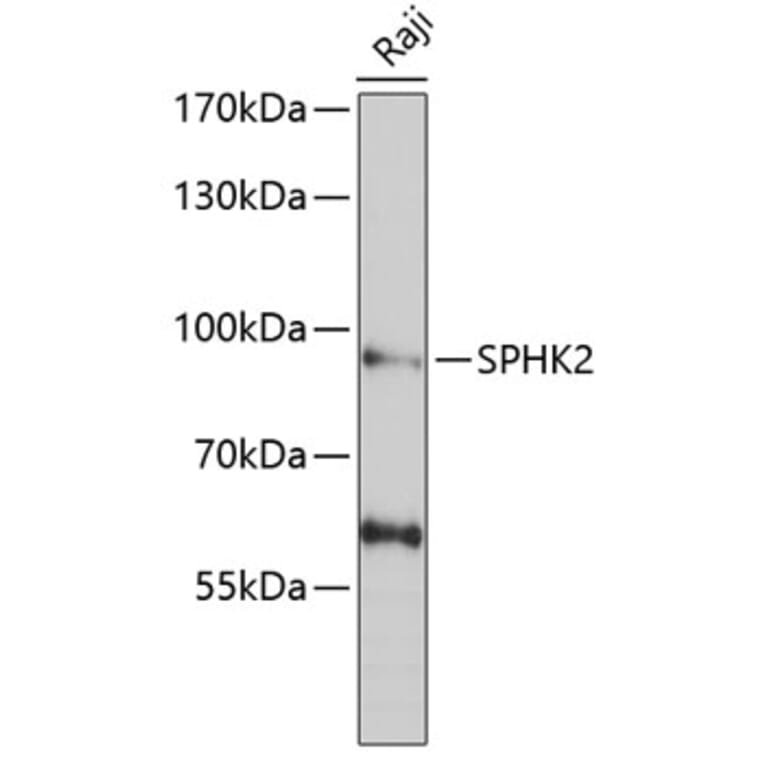 Western Blot - Anti-SPHK2 Antibody (A9987) - Antibodies.com