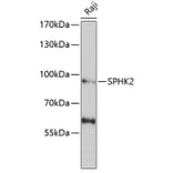 Western Blot - Anti-SPHK2 Antibody (A9987) - Antibodies.com