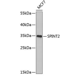 Western Blot - Anti-HGFA Inhibitor 2 Antibody (A9988) - Antibodies.com