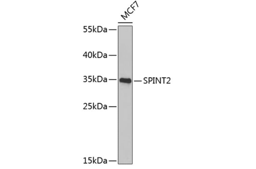 Western Blot - Anti-HGFA Inhibitor 2 Antibody (A9988) - Antibodies.com