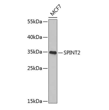 Western Blot - Anti-HGFA Inhibitor 2 Antibody (A9988) - Antibodies.com