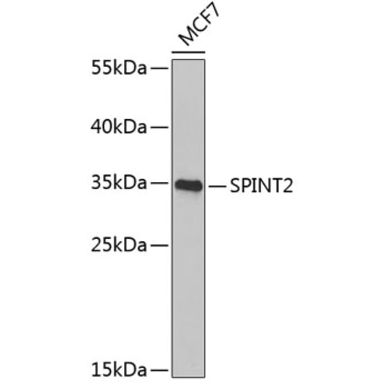 Western Blot - Anti-HGFA Inhibitor 2 Antibody (A9988) - Antibodies.com