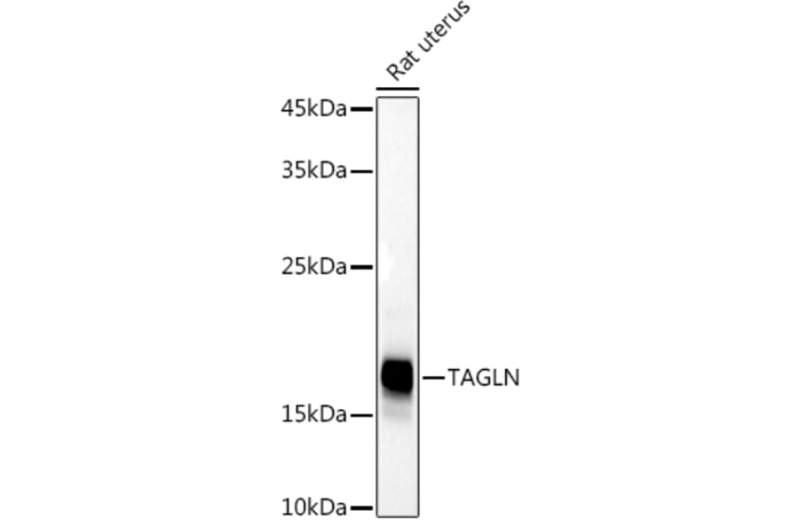 Western Blot - Anti-TAGLN / Transgelin Antibody (A9989) - Antibodies.com