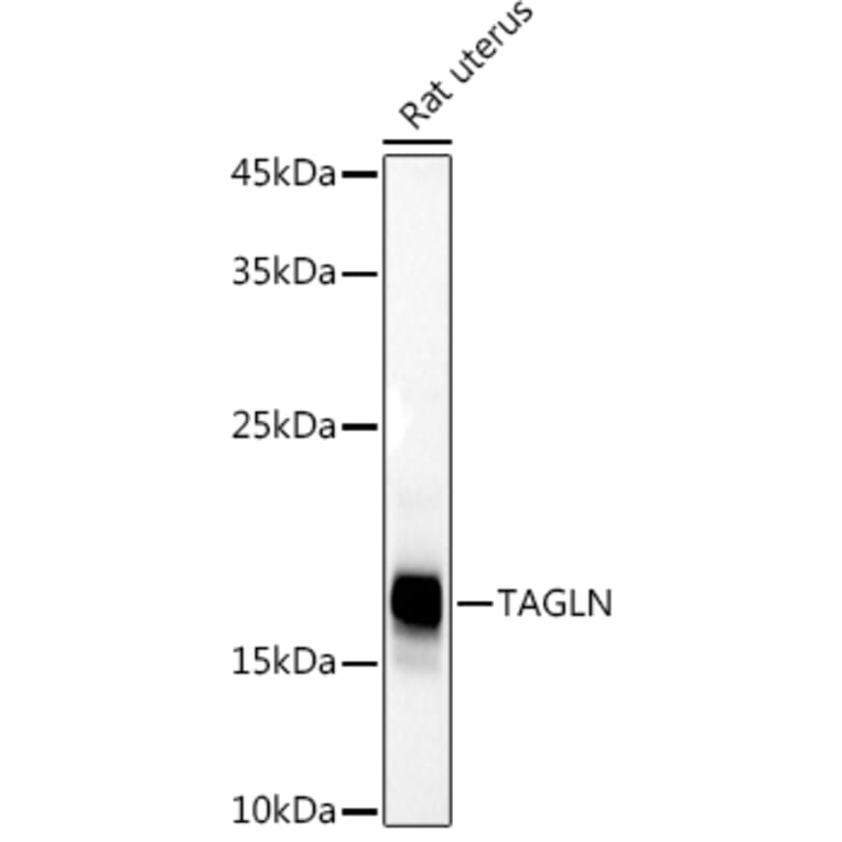 Western Blot - Anti-TAGLN / Transgelin Antibody (A9989) - Antibodies.com