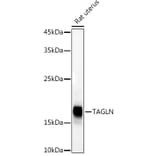 Western Blot - Anti-TAGLN / Transgelin Antibody (A9989) - Antibodies.com