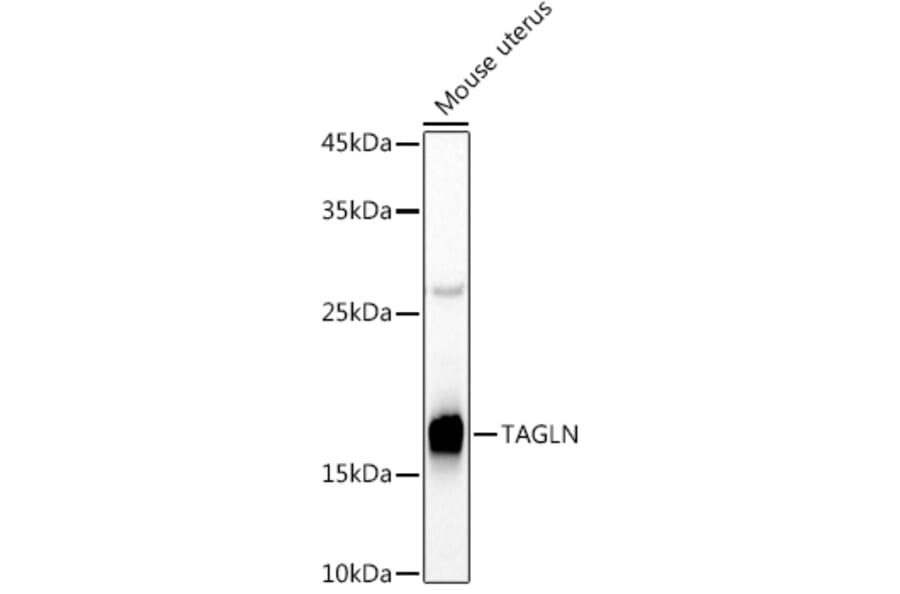 Western Blot - Anti-TAGLN / Transgelin Antibody (A9989) - Antibodies.com