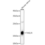 Western Blot - Anti-TAGLN / Transgelin Antibody (A9989) - Antibodies.com