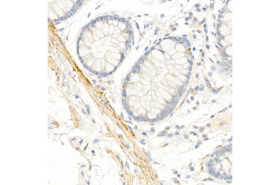 Immunohistochemistry - Anti-TAGLN / Transgelin Antibody (A9989) - Antibodies.com