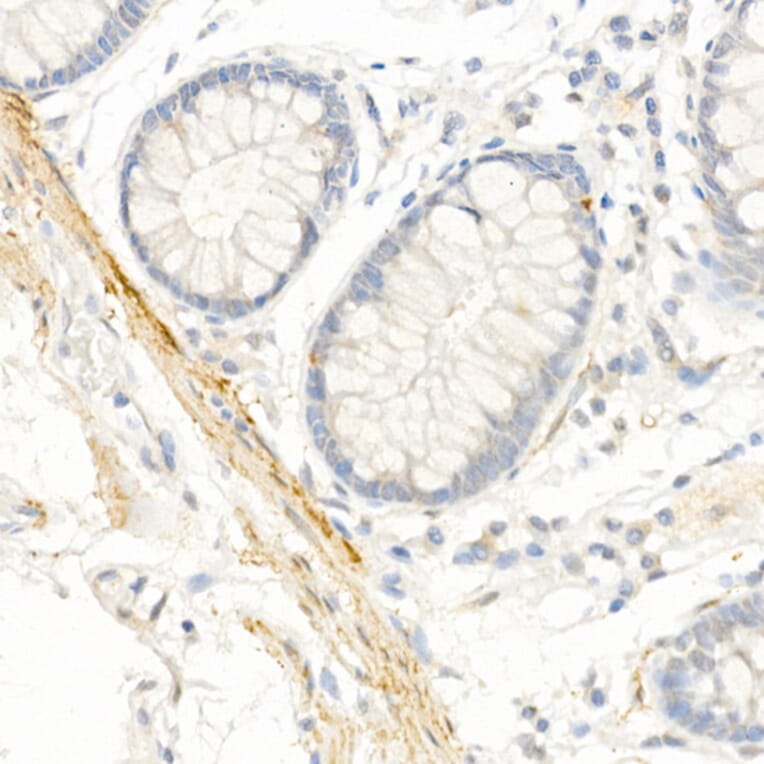 Immunohistochemistry - Anti-TAGLN / Transgelin Antibody (A9989) - Antibodies.com