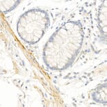 Immunohistochemistry - Anti-TAGLN / Transgelin Antibody (A9989) - Antibodies.com