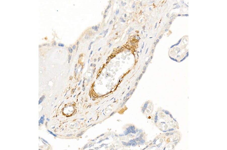 Immunohistochemistry - Anti-TAGLN / Transgelin Antibody (A9989) - Antibodies.com