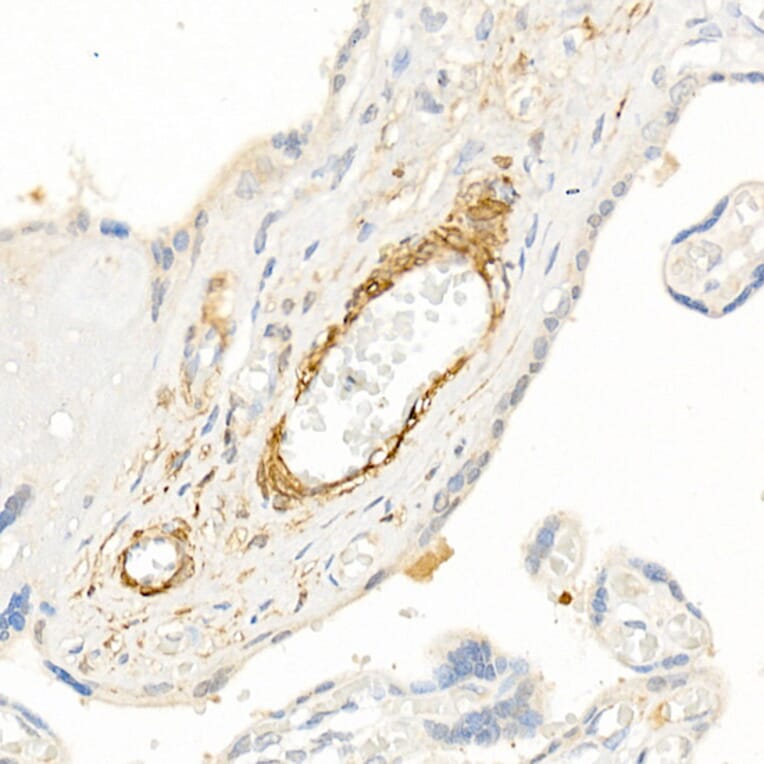 Immunohistochemistry - Anti-TAGLN / Transgelin Antibody (A9989) - Antibodies.com