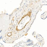 Immunohistochemistry - Anti-TAGLN / Transgelin Antibody (A9989) - Antibodies.com