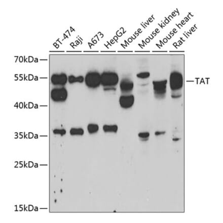 Western Blot - Anti-ATTY Antibody (A9991) - Antibodies.com