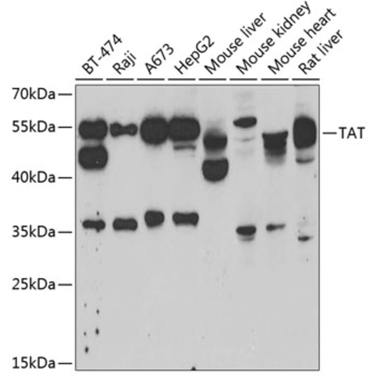 Western Blot - Anti-ATTY Antibody (A9991) - Antibodies.com